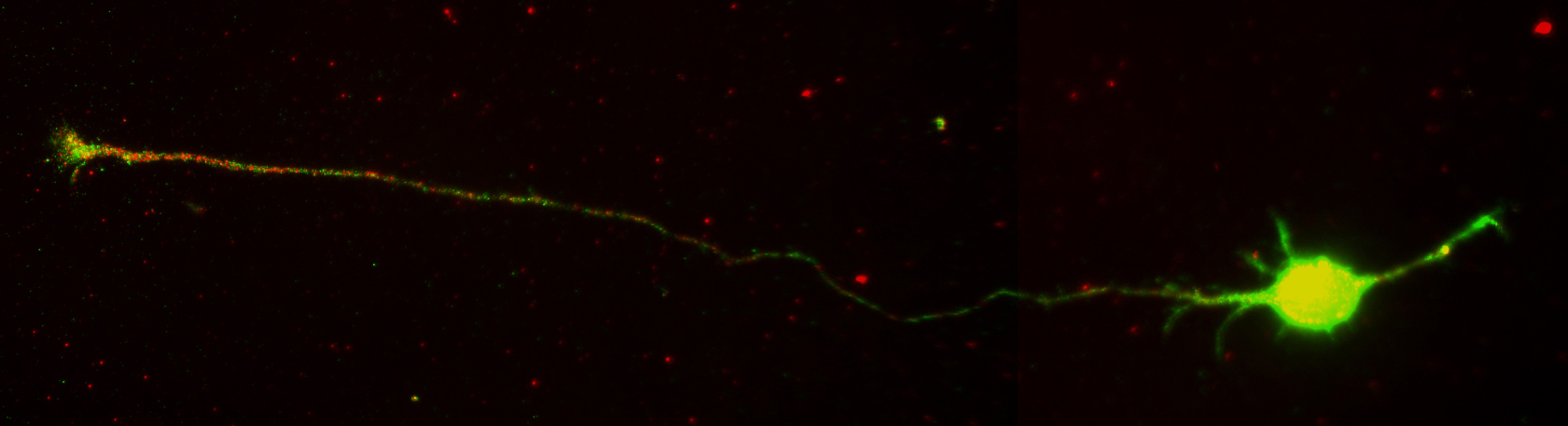 Hippocampal neuron