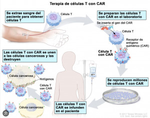 El tratamiento con células CAR-T es de los mas novedosos contra ciertos tipos de cánceres.