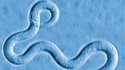 Elefantiasis 8079131