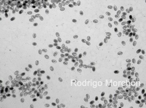 rodrigo-morchocc81n-huevos-de-ascaridia-galli-4x